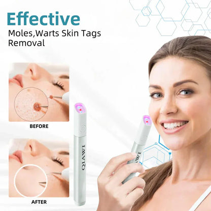 🔥First 100 :2nd ltem 60% Off🔥All-in-One CO₂ Laser Eraser Pen | Removes Moles, Warts, Skin Flaws & Pigmentation