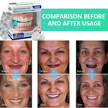 🔥First 100 :2nd ltem 60% Off🔥Dresfa® Medical Full Denture with Strong Suction ✅ Made and Shipped from the USA🍀