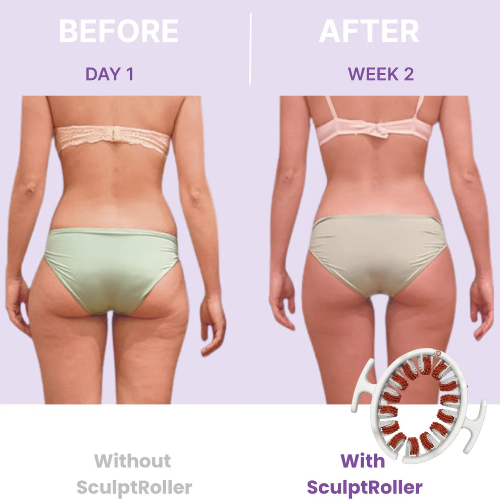 🔥Limited Time 50% OFF🔥 Cellulite Muscle Massager Roller for Men & Women | High-Density Polypropylene Skin Friendly Material |