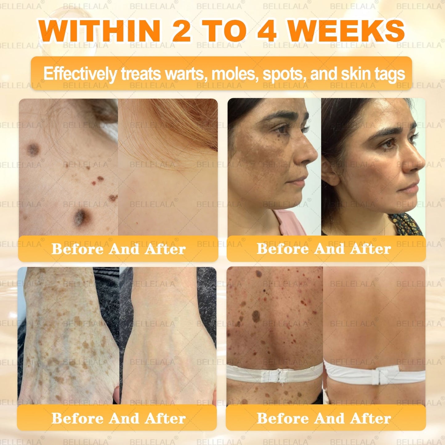 Hot Save 🥇 𝖡𝖾𝖾 𝗏𝖾𝗇𝗈𝗆 𝖲𝗄𝗂𝗇 𝖱𝖾𝗌𝗍𝗈𝗋𝖺𝗍𝗂𝗈𝗇 𝖢𝗋𝖾𝖺𝗆