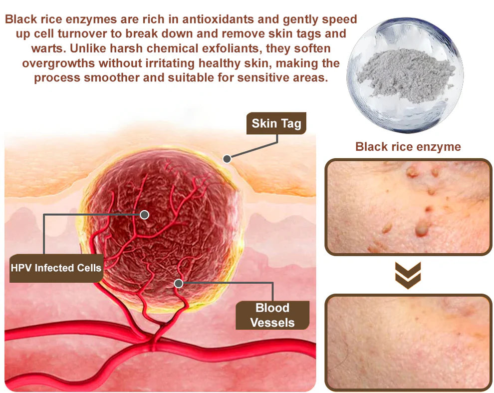 🔥First 100 :2nd ltem 60% Off🔥Black Rice Soothing Repair Cream