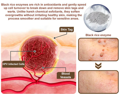 🔥First 100 :2nd ltem 60% Off🔥Black Rice Soothing Repair Cream