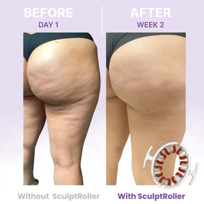 🔥Limited Time 50% OFF🔥 Cellulite Muscle Massager Roller for Men & Women | High-Density Polypropylene Skin Friendly Material |