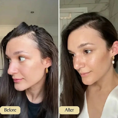 HOT SALE 🔥Natural Hair Growth Oil